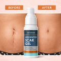 MÔOYAM – Gel Avancé Anti-Cicatrices